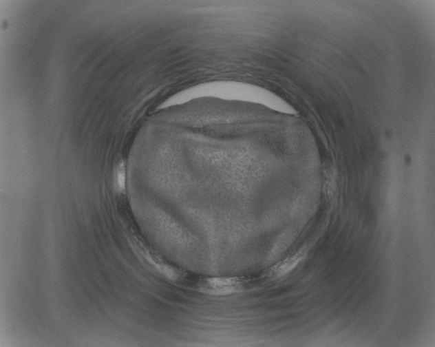 X0000081440095200702021728