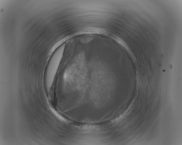 X0000081440842200702021715