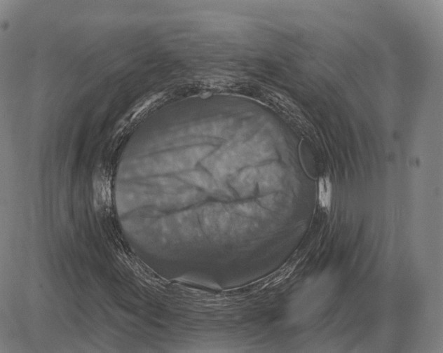 X0000081441155200702021710