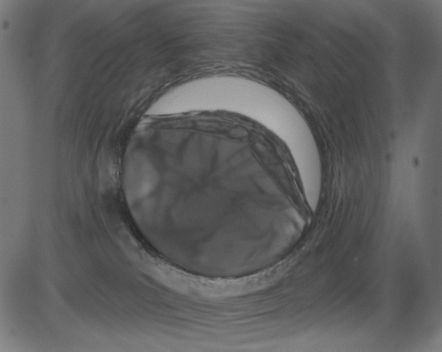 X0000081440039200702092236