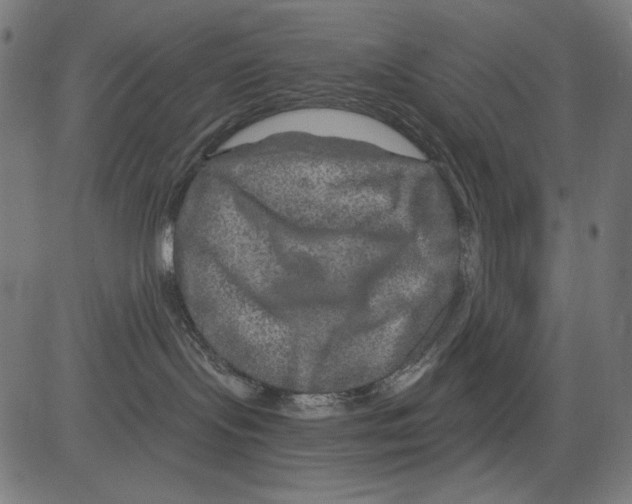 X0000081440095200702092235