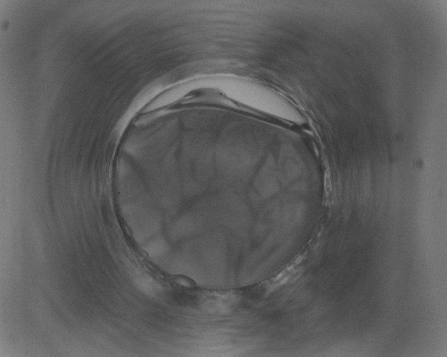 X0000081440099200702092235