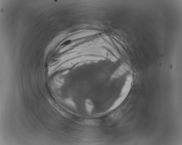X0000081440149200702092233