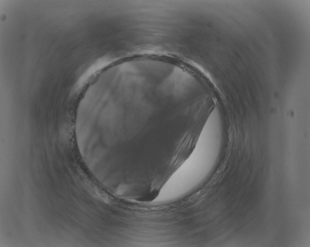 X0000081441359200702092214
