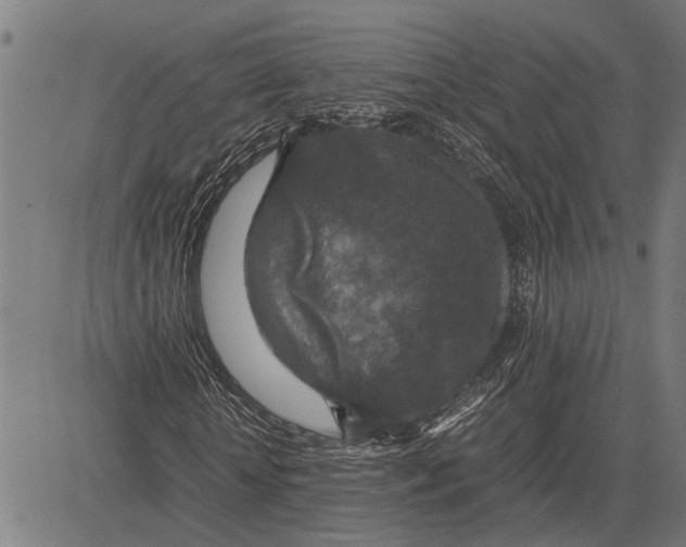 X0000081450818200702021740