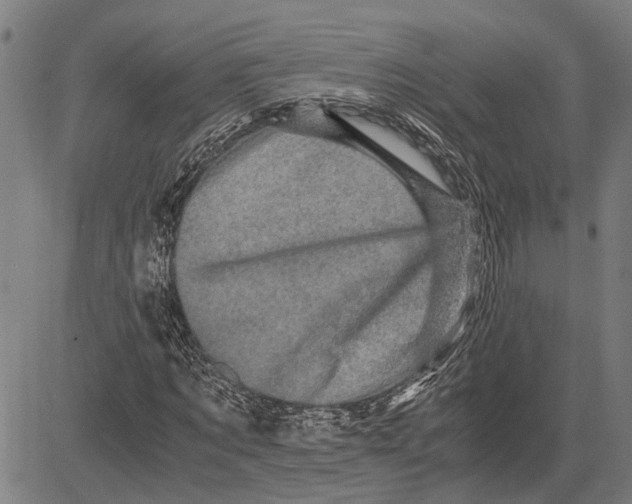 X0000081450869200702021740