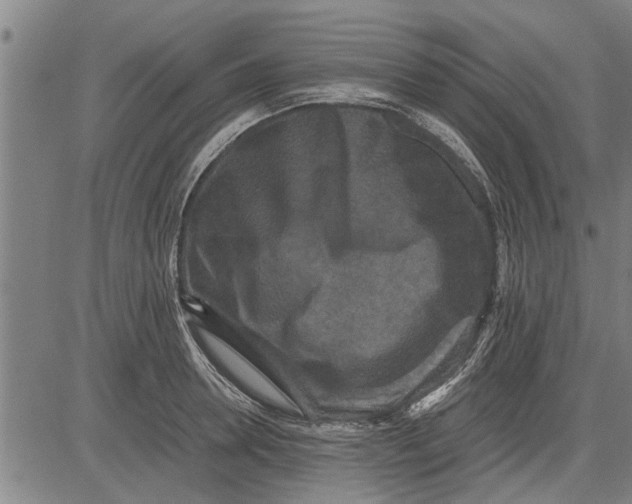 X0000081450946200702021739