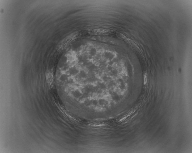 X0000081451011200702021737