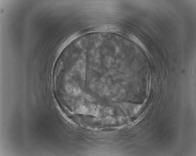 X0000081451087200702021736