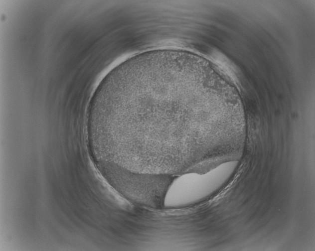 X0000081451142200702021736