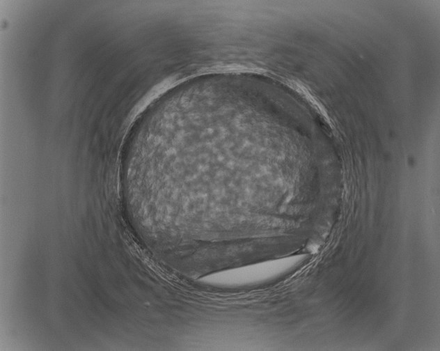 X0000081451173200702021735