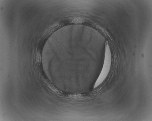 X0000081450517200702092253