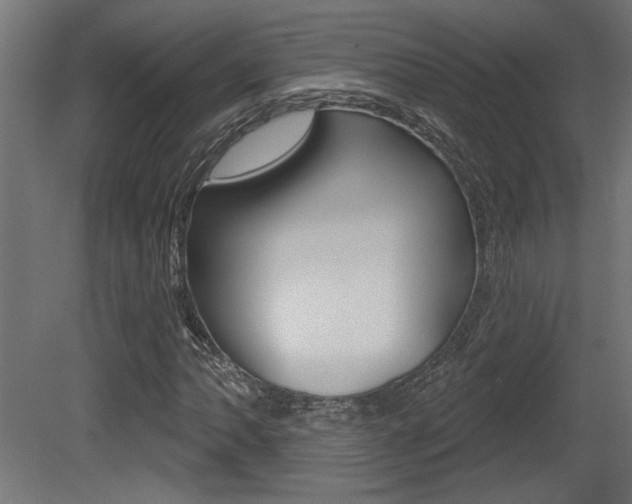X0000081461062200701121035