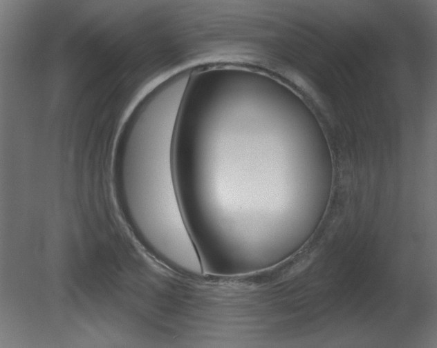 X0000081461077200701121035