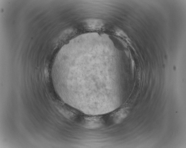 X0000081460516200701261941