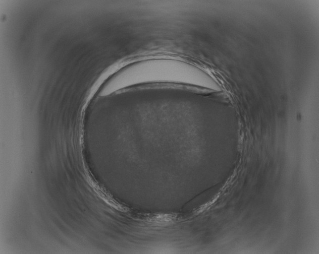X0000081460056200702021817