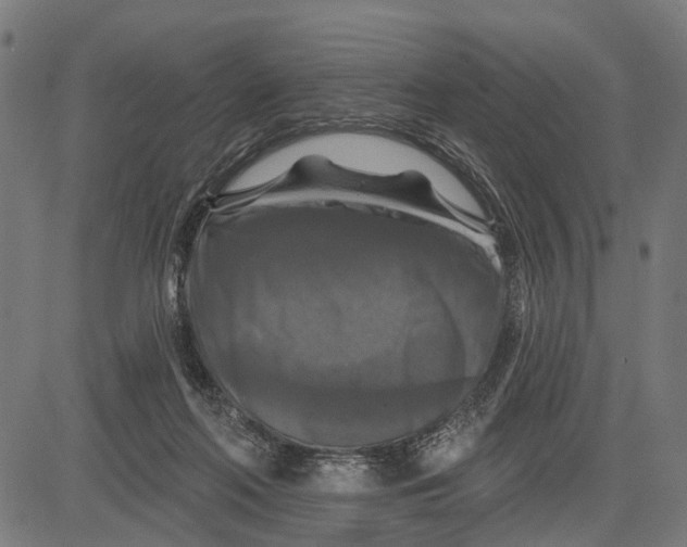 X0000081460214200702021815