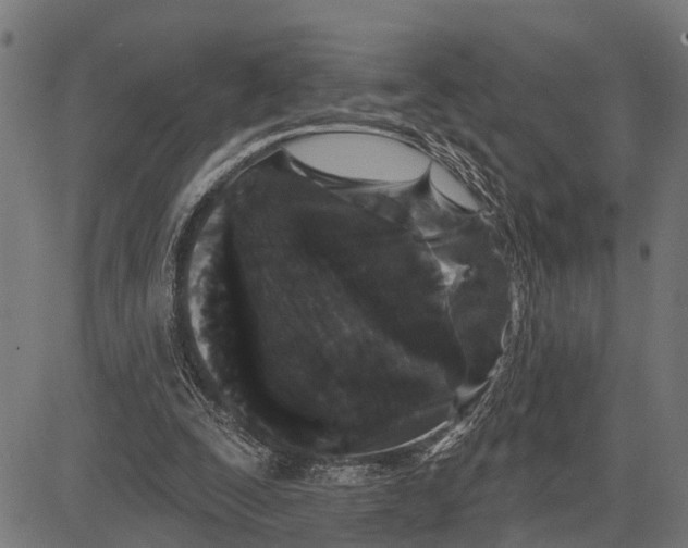 X0000081460295200702021814