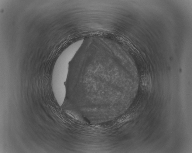 X0000081460916200702021803