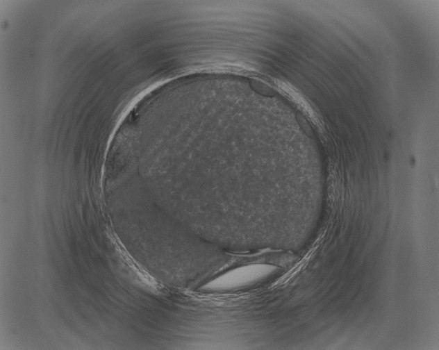 X0000081460932200702021804