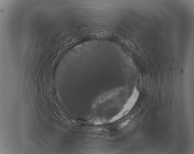 X0000081461009200702021802