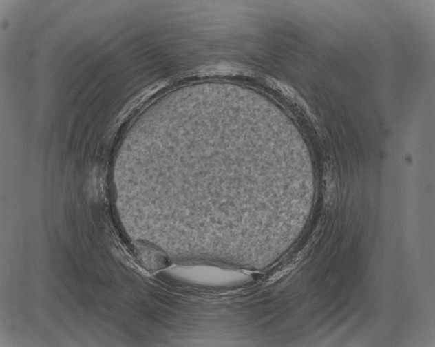 X0000081461217200702021759