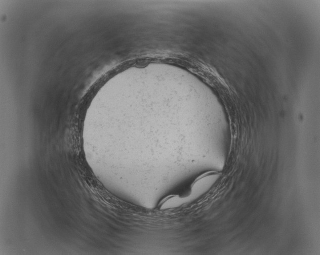 X0000081461256200702021758