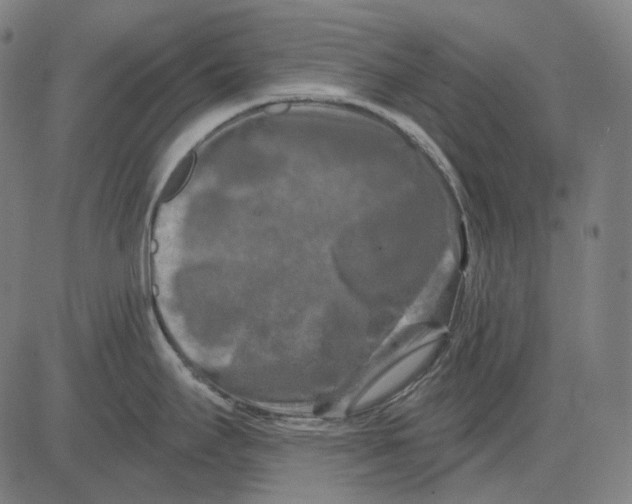 X0000081461295200702021758