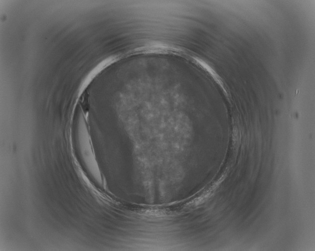 X0000081461418200702021756