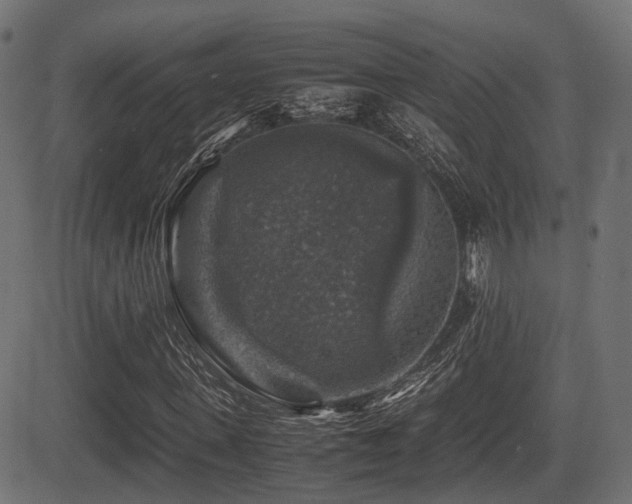X0000081470915200701121415
