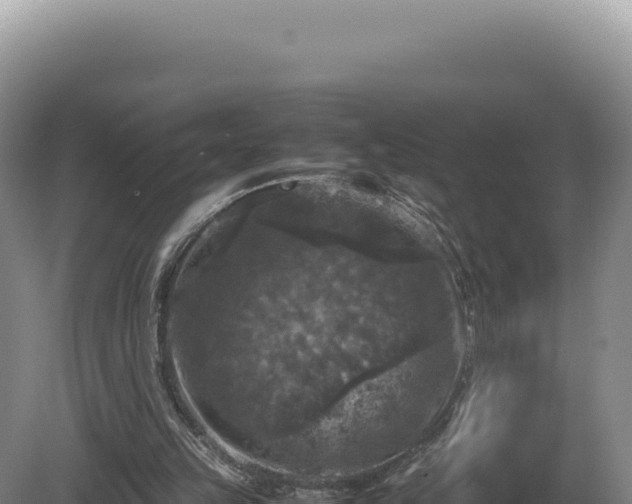 X0000081470149200701191815