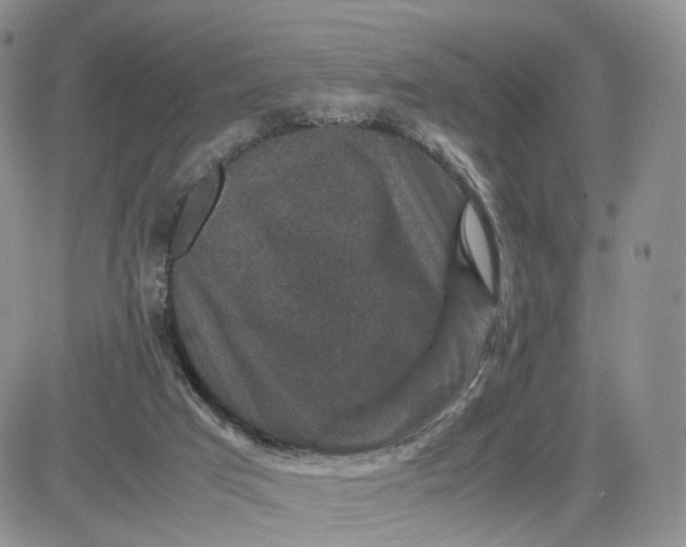 X0000081470017200701262014