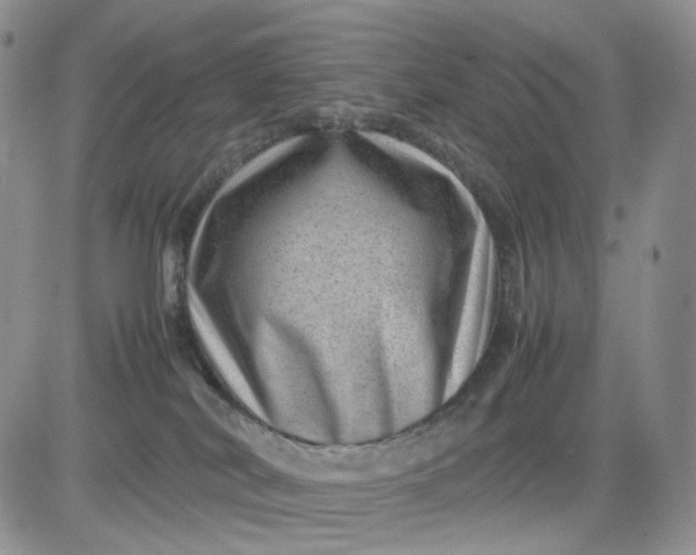 X0000081470038200701262014