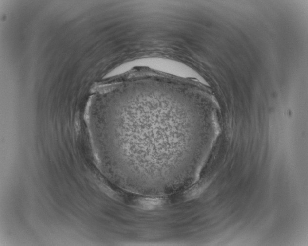 X0000081470085200701262014