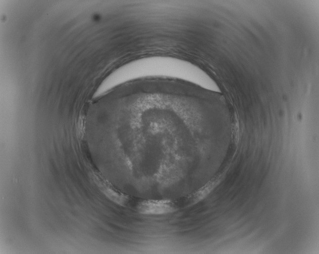 X0000081470093200701262014