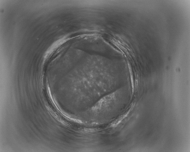 X0000081470149200701262011