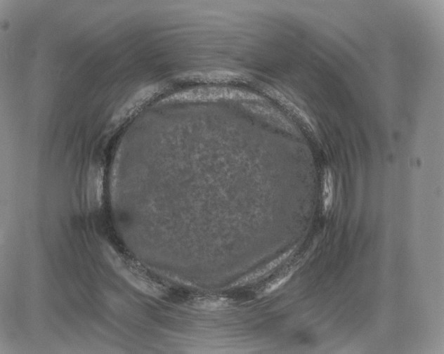 X0000081470206200701262011