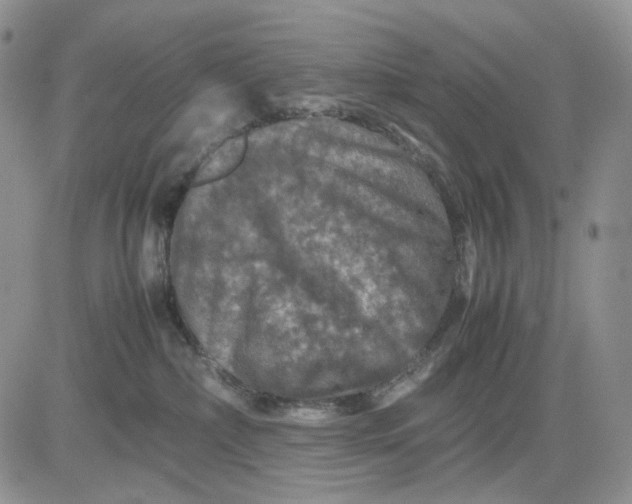 X0000081470236200701262011