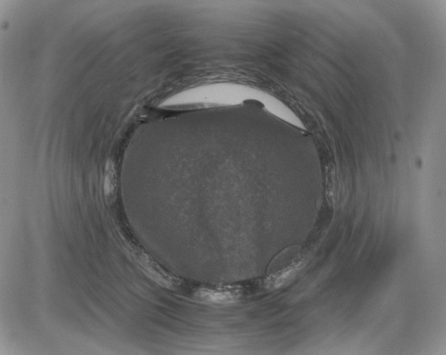 X0000081470563200701262006