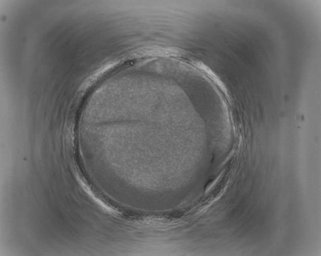 X0000081470581200701262005