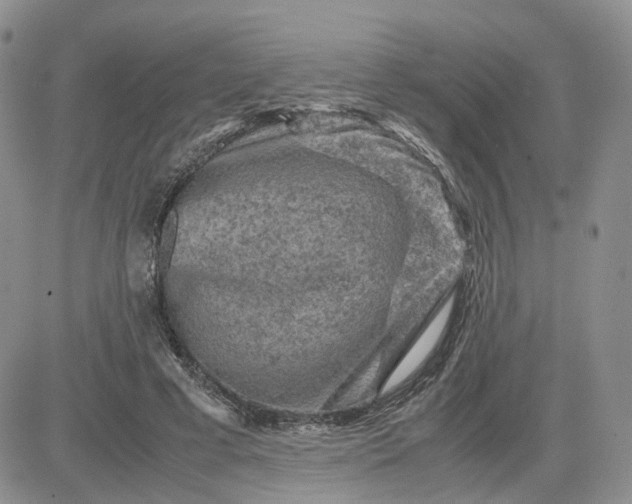 X0000081470593200701262005