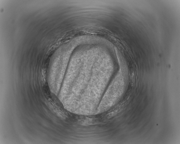 X0000081470772200701262002