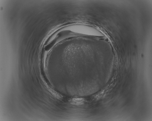 X0000081470055200702021842