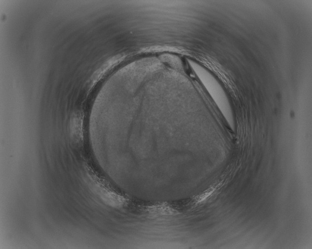 X0000081470112200702021842