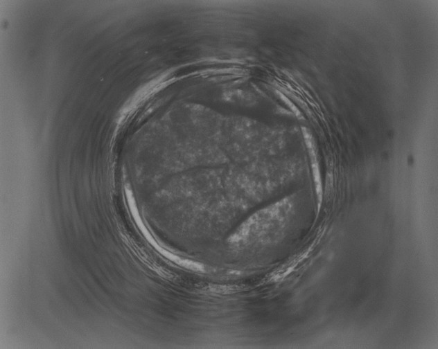 X0000081470149200702021841