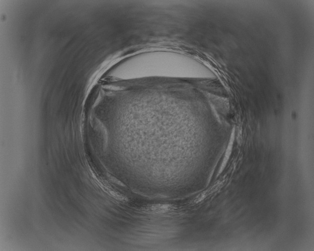 X0000081470152200702021841