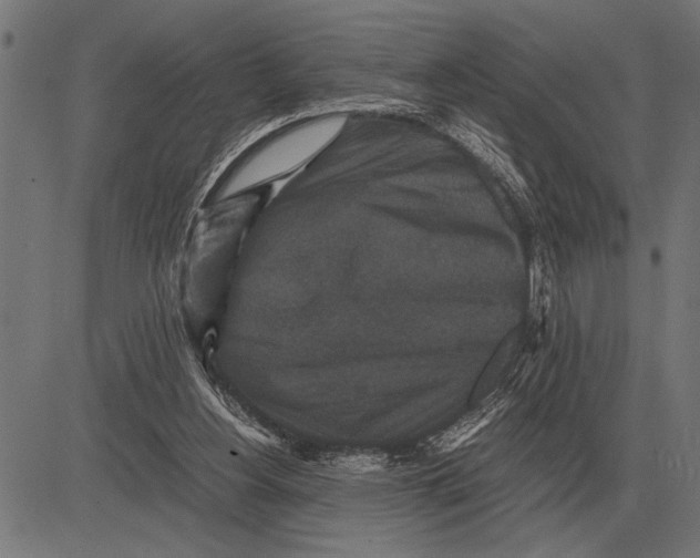 X0000081470156200702021841