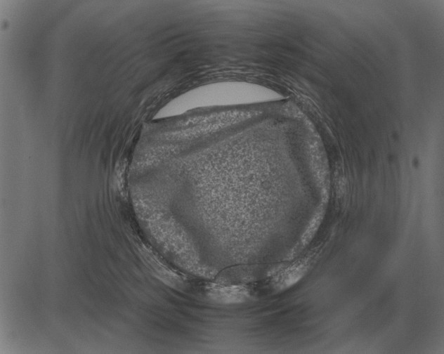 X0000081470185200702021841