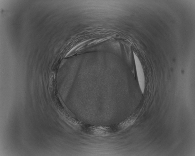 X0000081470229200702021840