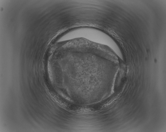 X0000081470256200702021839